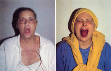 Wilke Intra Venus No 5 Diptych 1992